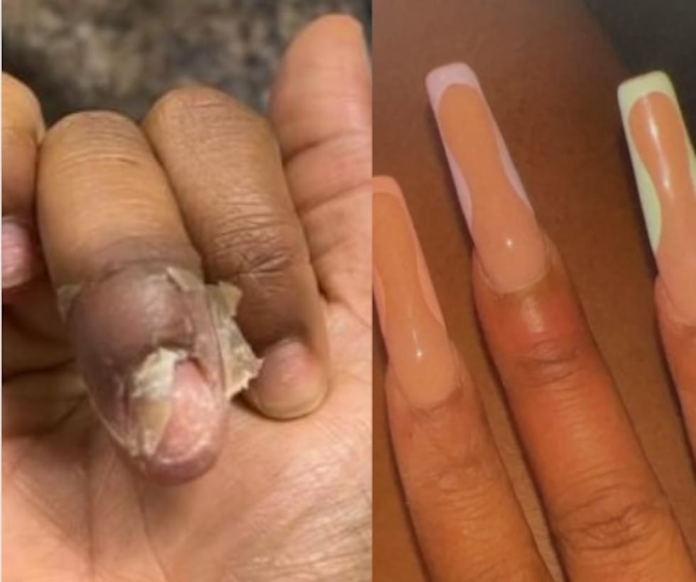 Constance Zelaya says the photo on the right is her manicure right after she got it and the...